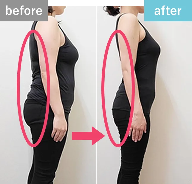 before-after